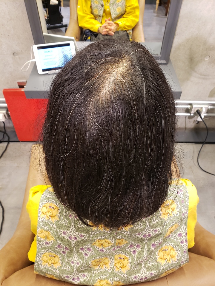 女性の薄毛を解決するために美容院でパーマを体験 その効果とは Careblog Magnolia マグノリア 東京 表参道にあるパーマが得意なヘアサロン